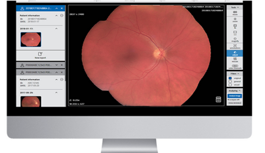 Fundus Photography