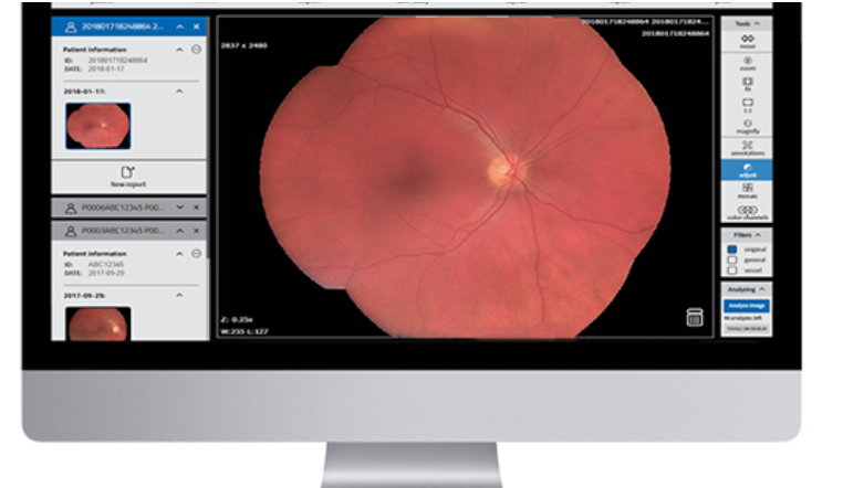 Fundus Photography